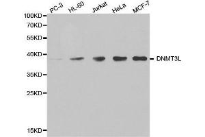 Western blot analysis of extracts of various cell lines, using DNMT3L antibody. (DNMT3L anticorps  (AA 1-386))