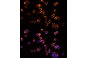Immunofluorescence analysis of THP-1 cells using CLIC1 Rabbit pAb (ABIN6128983, ABIN6138719, ABIN6138721 and ABIN6217770) at dilution of 1:150 (40x lens).