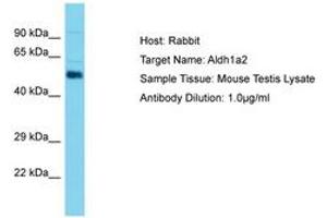 Image no. 1 for anti-Aldehyde Dehydrogenase 1 Family, Member A2 (ALDH1A2) (C-Term) antibody (ABIN6750430)