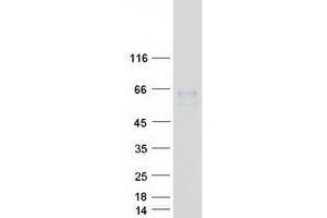 Validation with Western Blot