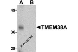 Western Blotting (WB) image for anti-Transmembrane Protein 38A (TMEM38A) (C-Term) antibody (ABIN1030754) (TMEM38A anticorps  (C-Term))