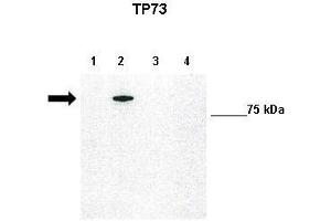 WB Suggested Anti-TP73 Antibody    Positive Control:  Lane1: 10ug untransfected H1299, Lane2: 10ug GFP-TAp73 transfected H1299, Lane3: 10ug GFP-DNp73 transfected H1299, Lane4: 10ug GFP-DBDp73 transfected H1299   Primary Antibody Dilution :   1:1000  Secondary Antibody :   Anti-rabbit-HRP   Secondry Antibody Dilution :   1:5000  Submitted by:  Francesca Grespi, VIB-Department for Molecular Biomedical Research, University of Gent (Tumor Protein p73 anticorps  (N-Term))