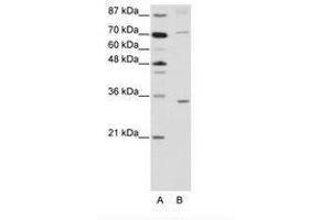 Image no. 1 for anti-Atonal Homolog 8 (ATOH8) (N-Term) antibody (ABIN202235) (ATOH8 anticorps  (N-Term))
