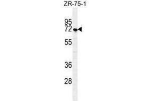 SUSD5 Antibody (C-term) western blot analysis in ZR-75-1 cell line lysates (35 µg/lane). (SUSD5 anticorps  (C-Term))