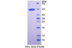 SDS-PAGE (SDS) image for WAP Four-Disulfide Core Domain 2 (WFDC2) (AA 30-124) protein (His tag,GST tag) (ABIN1980697)
