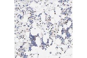 Immunohistochemical staining (Formalin-fixed paraffin-embedded sections) of human bone marrow with T polyclonal antibody  shows moderate nuclear positivity in a subset of bone marrow poietic cells at 1:20-1:50 dilution. (T Antigen anticorps)