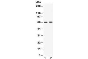 Western blot testing of human 1) MCF7 and 2) MM453 lysate with Nectin-4 antibody at 0. (PVRL4 anticorps  (AA 53-94))