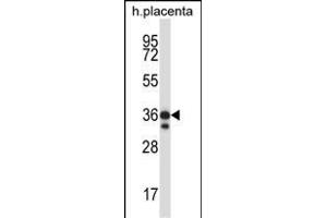 Mouse Mst4 Antibody (Center) (ABIN657993 and ABIN2846939) western blot analysis in human placenta tissue lysates (35 μg/lane). (STK26/MST4 anticorps  (AA 271-299))