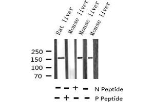 Western blot analysis of Phospho-EGFR (Tyr1110) expression in various lysates (EGFR anticorps  (pTyr1110))