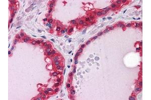 Immunohistochemical analysis of paraffin-embedded human Thyroid tissues using ST13 mouse mAb (HSC70 Interacting Protein HIP anticorps)