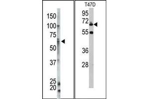 Image no. 1 for anti-Ubiquilin 1 (UBQLN1) (N-Term) antibody (ABIN357617) (Ubiquilin 1 anticorps  (N-Term))