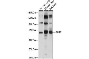 Western blot analysis of extracts of various cell lines, using FUT7 Antibody (ABIN6133982, ABIN6140825, ABIN6140826 and ABIN6224983) at 1:1000 dilution. (FUT7 anticorps  (AA 100-200))