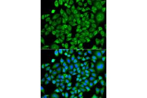 Immunofluorescence analysis of A549 cells using NAA50 antibody. (NAA50 anticorps)