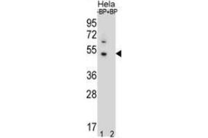 Western blot analysis of DNAJB6 (arrow) pre-incubated without (lane 1) and with (lane 2) blocking peptide in Hela cell line lysate using DNAJB6  Antibody  (1:60/250 dilution). (DNAJB6 anticorps  (Middle Region))