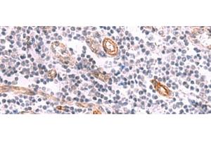 Immunohistochemistry of paraffin-embedded Human tonsil tissue using KCNK15 Polyclonal Antibody at dilution of 1:45(x200)