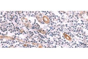 Immunohistochemistry of paraffin-embedded Human tonsil tissue using KCNK15 Polyclonal Antibody at dilution of 1:45(x200) (KCNK15 anticorps)