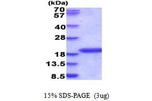 SDS-PAGE (SDS) image for Interleukin 1 delta (FIL1d) (AA 1-155) protein (His tag) (ABIN5853887) (FIL1d Protein (AA 1-155) (His tag))