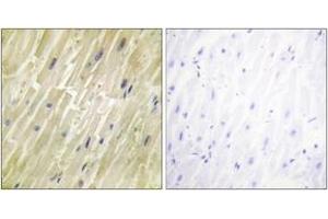 Immunohistochemistry analysis of paraffin-embedded human heart tissue, using M-CK Antibody.