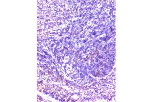 IHC analysis of cortactin using anti-cortactin antibody (ABIN6719306). (Cortactin anticorps  (AA 1-105))