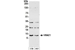 Western Blotting (WB) image for anti-Vacuolar H+-ATPase Homolog (VMA21) (AA 51-101) antibody (ABIN7452645)