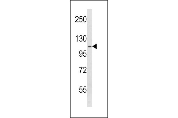 SPINK5 antibody  (N-Term)