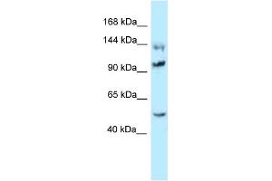 WB Suggested Anti-Hsph1 Antibody Titration: 1. (HSPH1 anticorps  (C-Term))