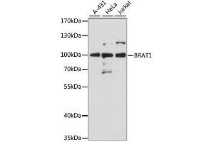 Western blot analysis of extracts of various cell lines, using Brat1 antibody (ABIN6290105) at 1:3000 dilution. (BAAT1 anticorps)