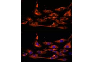 Immunofluorescence analysis of C6 cells using  antibody (ABIN7265422) at dilution of 1:100.