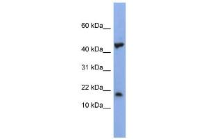 WB Suggested Anti-LSM1 Antibody Titration: 0. (LSM1 anticorps  (Middle Region))