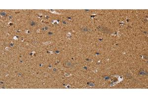 Immunohistochemistry of paraffin-embedded Human brain using DDAH1 Polyclonal Antibody at dilution of 1:50
