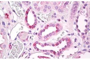 Anti-STRADB / ALS2CR2 antibody IHC staining of human kidney, tubules. (STRADB anticorps  (AA 200-250))