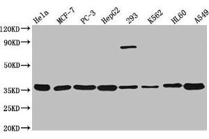 Western Blot Positive WB detected in: Hela whole cell lysate, MCF-7 whole cell lysate, PC-3 whole cell lysate, HepG2 whole cell lysate, 293 whole cell lysate, K562 whole cell lysate, HL60 whole cell lysate, A549 whole cell lysate All lanes: ANXA5 antibody at 1:3000 Secondary Goat polyclonal to rabbit IgG at 1/50000 dilution Predicted band size: 36 kDa Observed band size: 36 kDa (Annexin V anticorps  (AA 2-320))