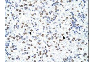 Image no. 3 for anti-Heterogeneous Nuclear Ribonucleoprotein D (HNRNPD) (C-Term) antibody (ABIN203266)