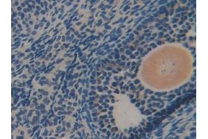 Detection of DLD in Mouse Ovary Tissue using Polyclonal Antibody to Dihydrolipoyl Dehydrogenase (DLD) (DLD anticorps  (AA 45-271))