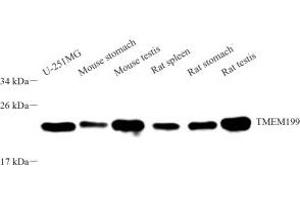 Western blot analysis of TMEM199 (ABIN7075998) at dilution of 1: 2000 (TMEM199 anticorps)