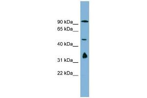 MAK10 antibody used at 1 ug/ml to detect target protein. (MAK10/NAA35 anticorps  (N-Term))