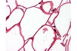 Anti-SHC1 antibody IHC of human adipocytes.