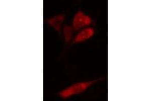 ABIN6274924 staining HepG2 cells by IF/ICC. (BAIAP2L1 anticorps  (Internal Region))