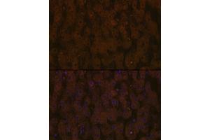 Immunofluorescence analysis of human liver using Apolipoprotein C3 Rabbit mAb (ABIN7265640) at dilution of 1:100 (40x lens).