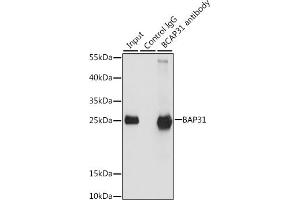 Immunoprecipitation analysis of 200 μg extracts of HeLa cells, using 3 μg B antibody (ABIN6129973, ABIN6137477, ABIN6137478 and ABIN6222845). (BCAP31 anticorps  (AA 127-246))