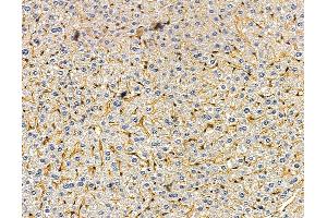 anti-Calcium Regulated Heat Stable Protein 1, 24kDa (CARHSP1) antibody