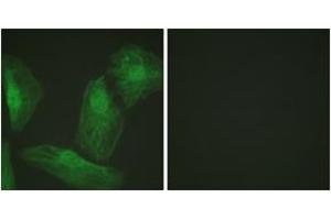 Immunofluorescence analysis of HeLa cells, using Smad2 (Ab-220) Antibody. (SMAD2 anticorps  (AA 186-235))