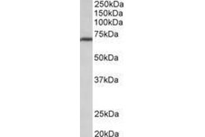 Image no. 1 for anti-Methylenetetrahydrofolate Reductase (NAD(P)H) (MTHFR) (AA 369-383) antibody (ABIN1103105) (MTHFR anticorps  (AA 369-383))