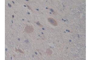 Detection of C7 in Rat Spinal cord Tissue using Polyclonal Antibody to Complement Component 7 (C7)