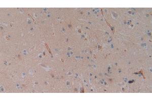 Detection of SLC9A3R2 in Human Cerebrum Tissue using Polyclonal Antibody to Sodium Hydrogen Exchange Regulatory Cofactor 2 (SLC9A3R2)