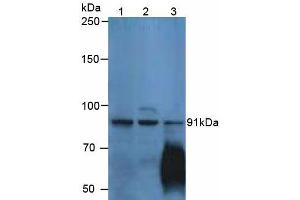 Figure. (P-Cadherin anticorps  (AA 371-660))