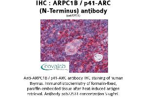 Image no. 1 for anti-Actin Related Protein 2/3 Complex, Subunit 1B, 41kDa (ARPC1B) (N-Term) antibody (ABIN1731962) (ARPC1B anticorps  (N-Term))