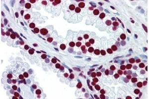 Human Prostate: Formalin-Fixed, Paraffin-Embedded (FFPE)