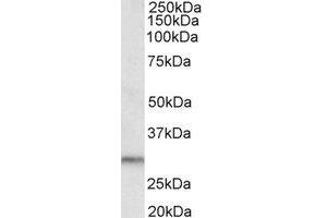 Western Blotting (WB) image for anti-Dual Adaptor of Phosphotyrosine and 3-phosphoinositides (DAPP1) (C-Term) antibody (ABIN2464796) (DAPP1 anticorps  (C-Term))