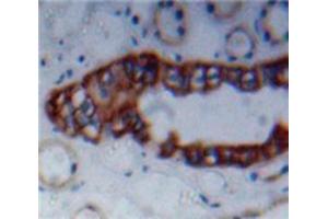 Used in DAB staining on fromalin fixed paraffin-embedded Kidney tissue